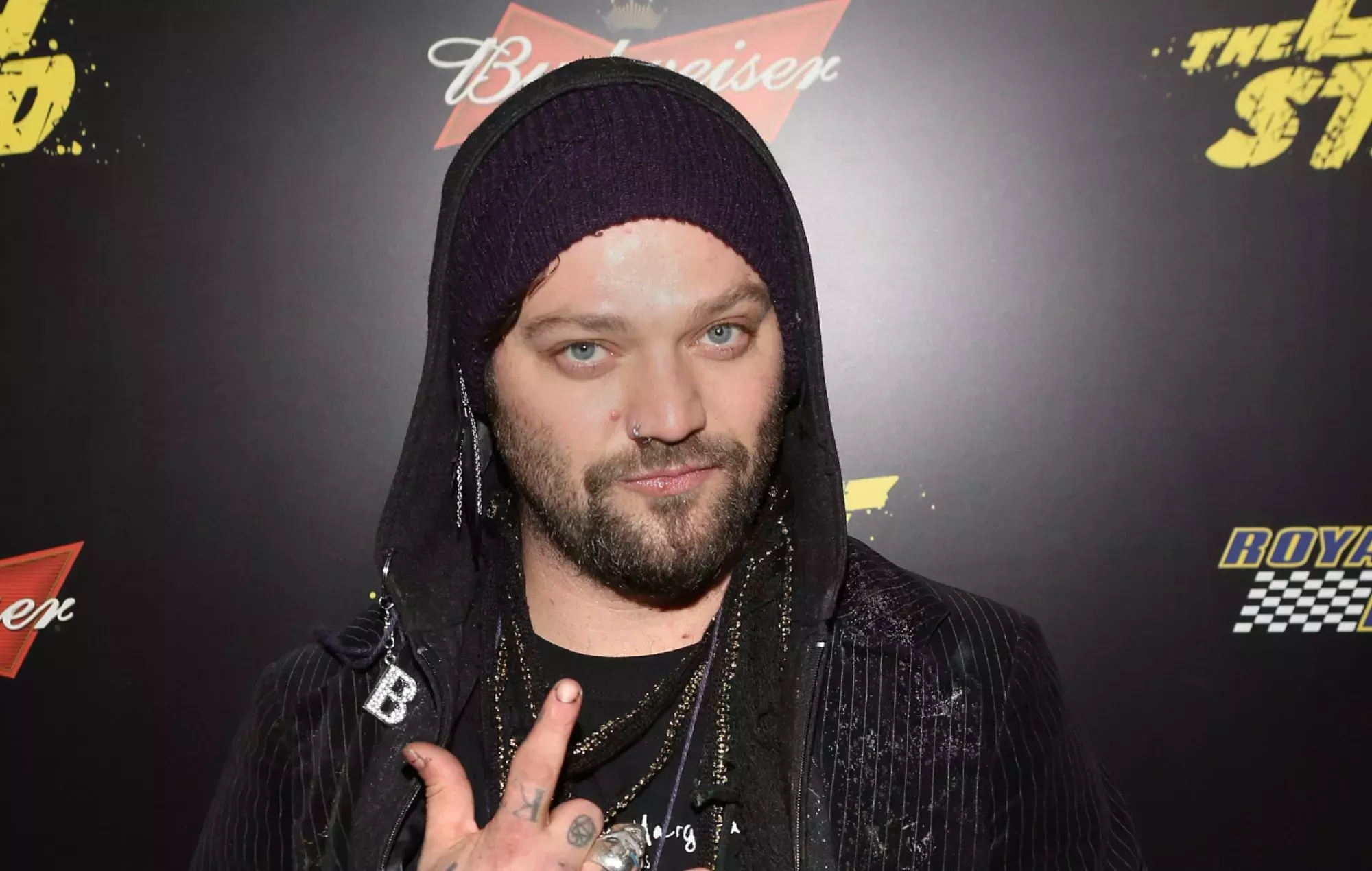 La estrella de 'Jackass' Bam Margera completa un programa de tratamiento contra el abuso de drogas y alcohol de un año de duración