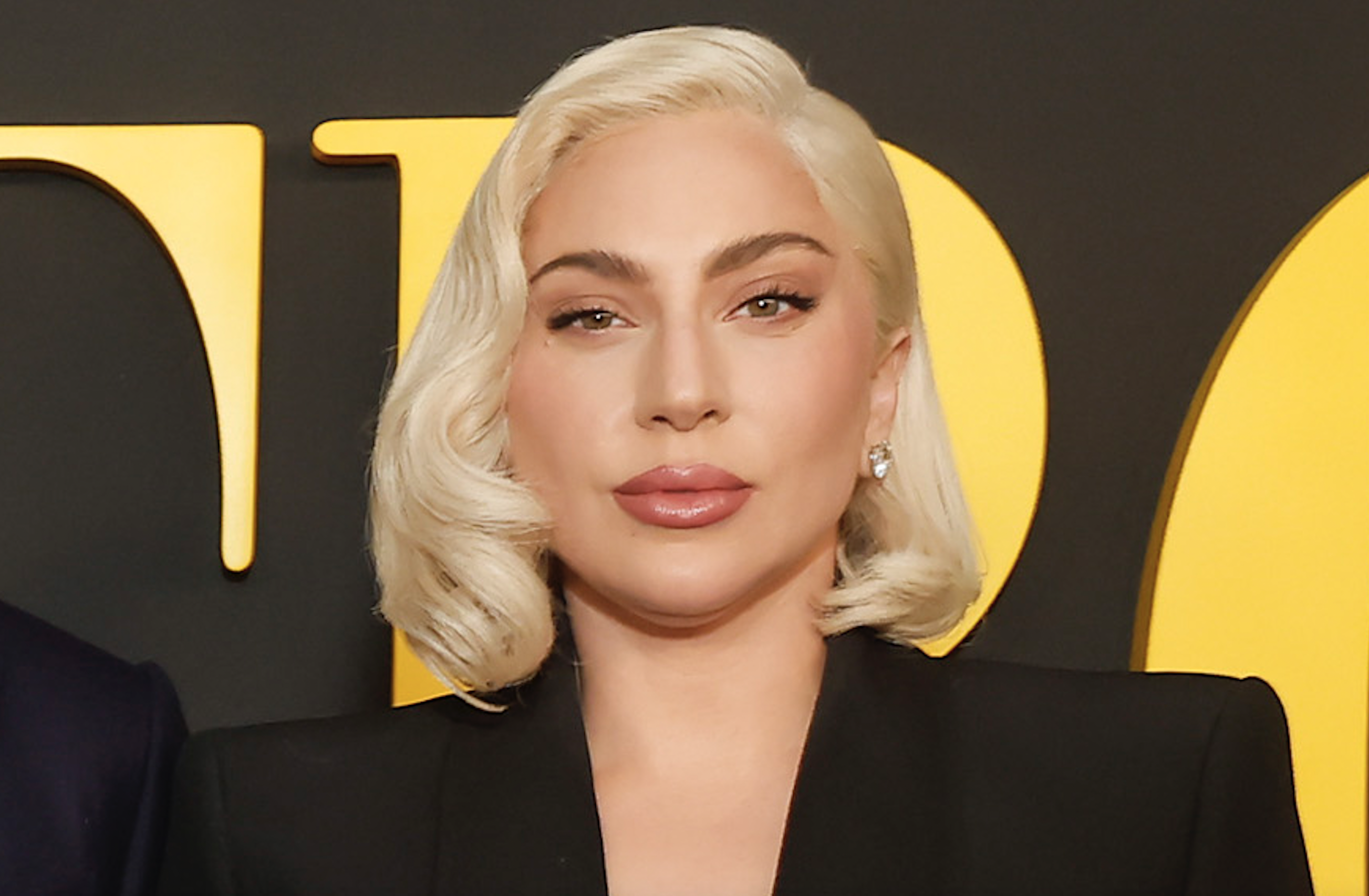 

	
		Lady Gaga lanzará esta semana su nuevo single "Disease
	
	