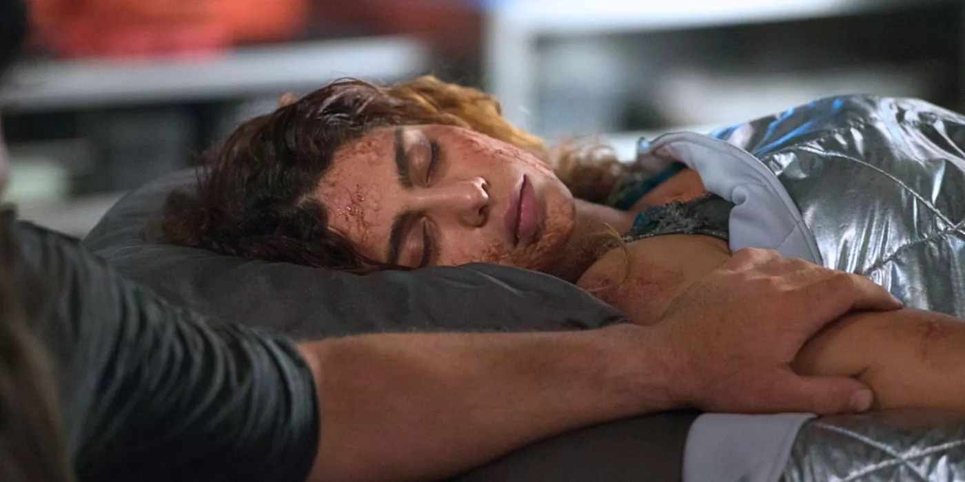 Nadia Hilker as Luna suffering from radiation burns in The 100